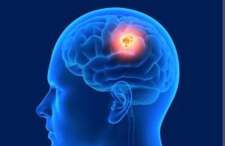 Brain tumor treatment options and neurosurgery costs in India